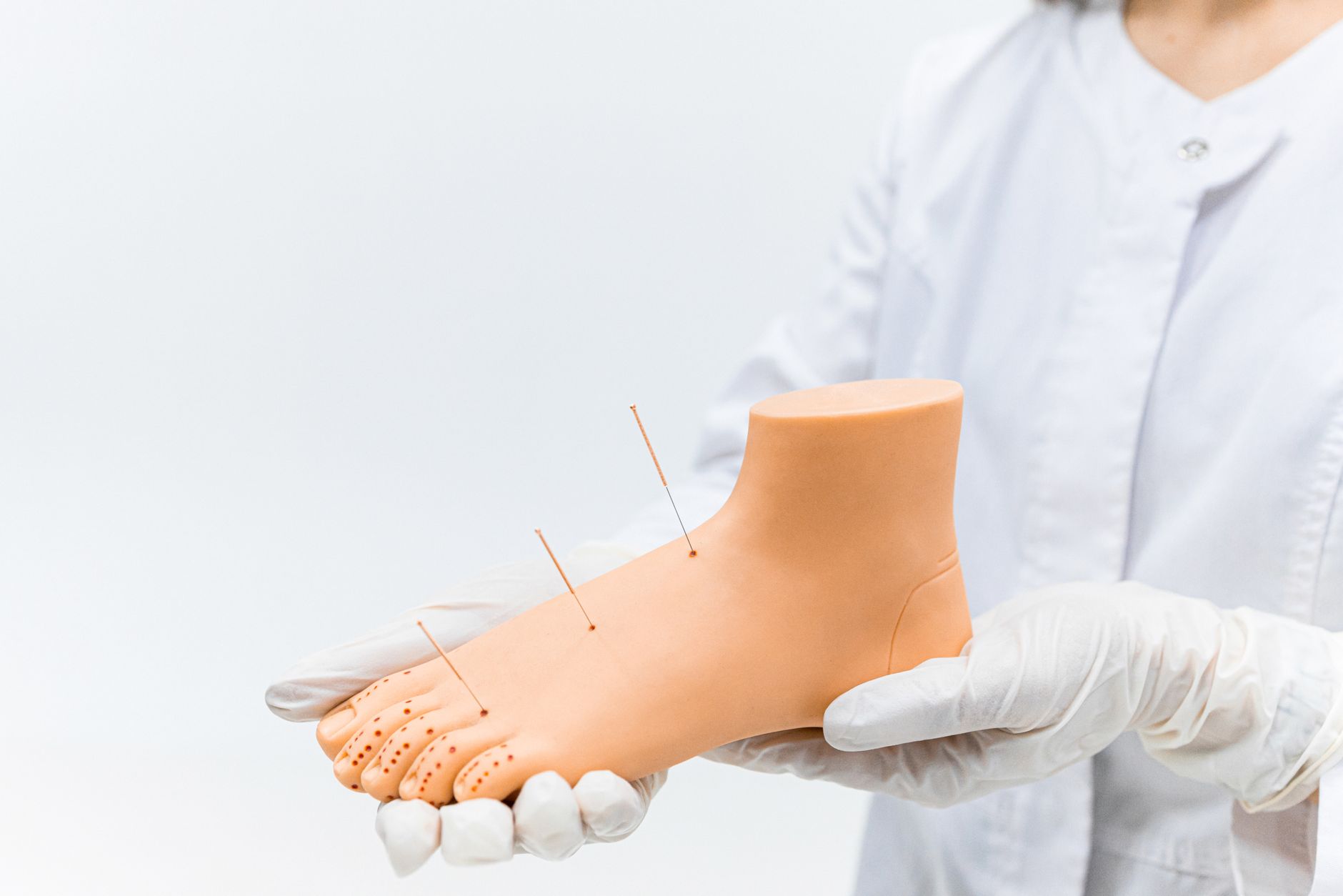 Acute Gouty Arthritis Support: A Practical UK Guide to Flare Care and Calm Companions - zdjecie w tresci